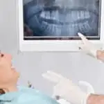 dental x-ray